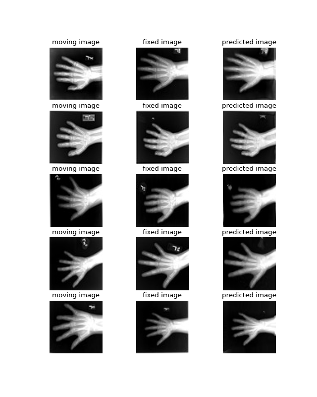 _images/monai_wrapper-7_01.png