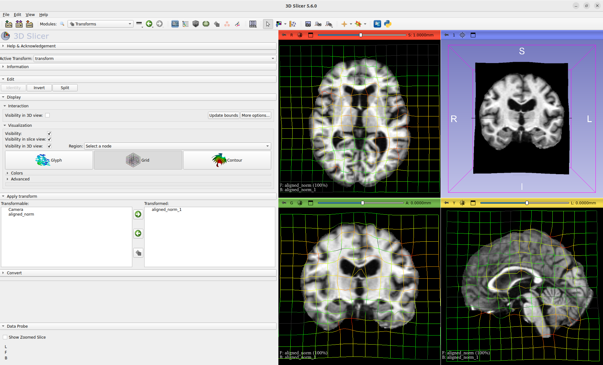 _images/slicer.png